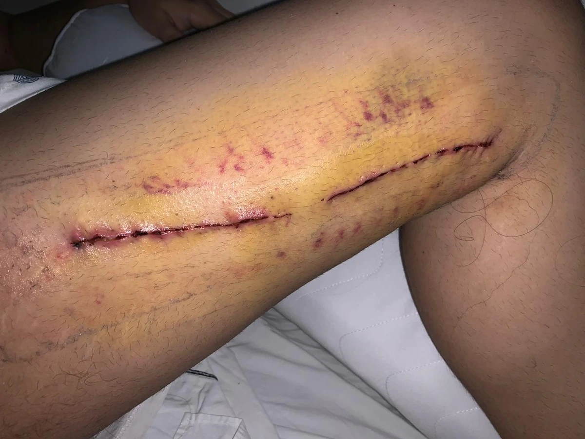 Cirurgia  por Fernanda Varela/CORREIO