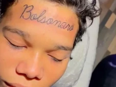 Imagem - Jovem se arrepende e remove tatuagem de Bolsonaro na testa: 'Minha família toda vota no Lula'