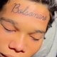 Imagem - Jovem se arrepende e remove tatuagem de Bolsonaro na testa: 'Minha família toda vota no Lula'