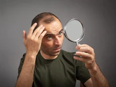 Imagem - Sem efeito colateral: estudo revela que adoçante natural combate a calvície e faz o cabelo crescer 3x mais que o minoxidil