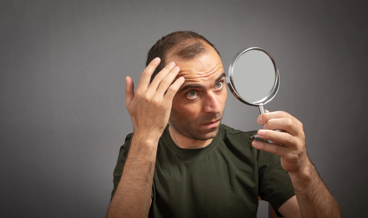 O uso de minoxidil (tópico ou oral em baixas doses) pode ajudar a desacelerar a queda e estimular o crescimento, mas deve ser prescrito por um médico por Shutterstock