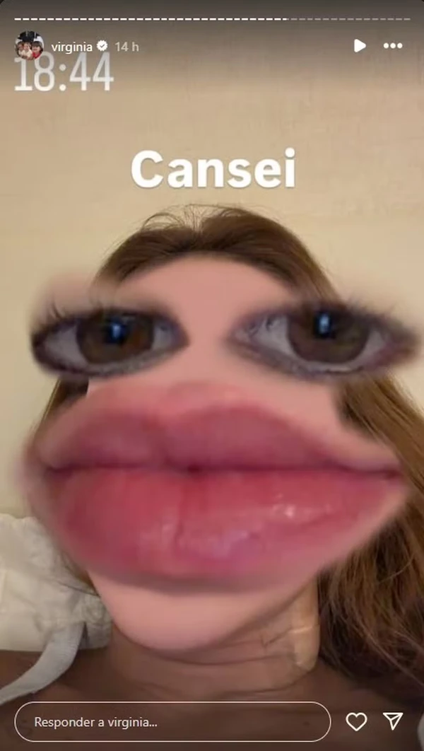 Virginia apareceu com curativo no pescoço após sessão de laser por Reprodução