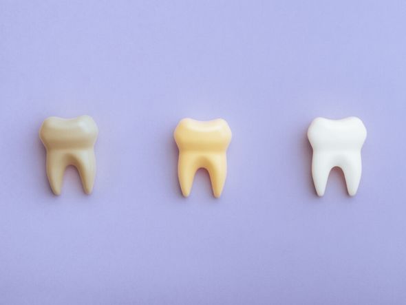 Imagem - 5 mitos e verdades sobre manchas nos dentes
