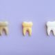 Imagem - 5 mitos e verdades sobre manchas nos dentes