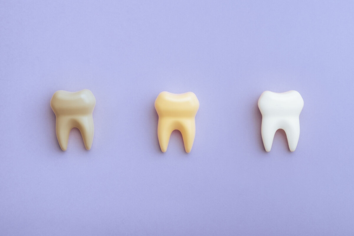 A alimentação e os hábitos diários estão entre os principais fatores que influenciam a cor dos dentes (Imagem: Nicoleta Ionescu | Shutterstock)