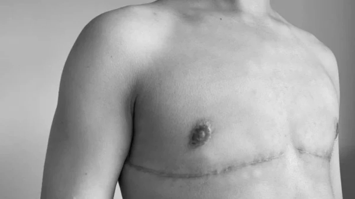 “Outubro Rosa: saúde mamária das pessoas transgênero e travestis” está na primeira edição por Sean92/Shutterstock