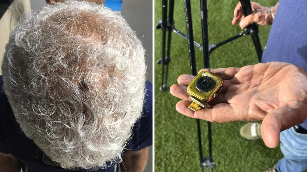 Profissional levou quatro pontos na cabeça