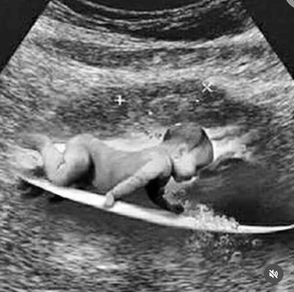 Gabriel Medina e Isabella Arantes compartilharam ultrassom estilizado por Reprodução/instagram