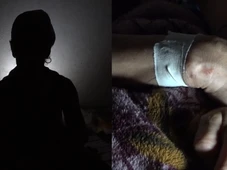 Imagem - Mulher sobrevive após ser estrangulada e enterrada viva por ex-companheiro