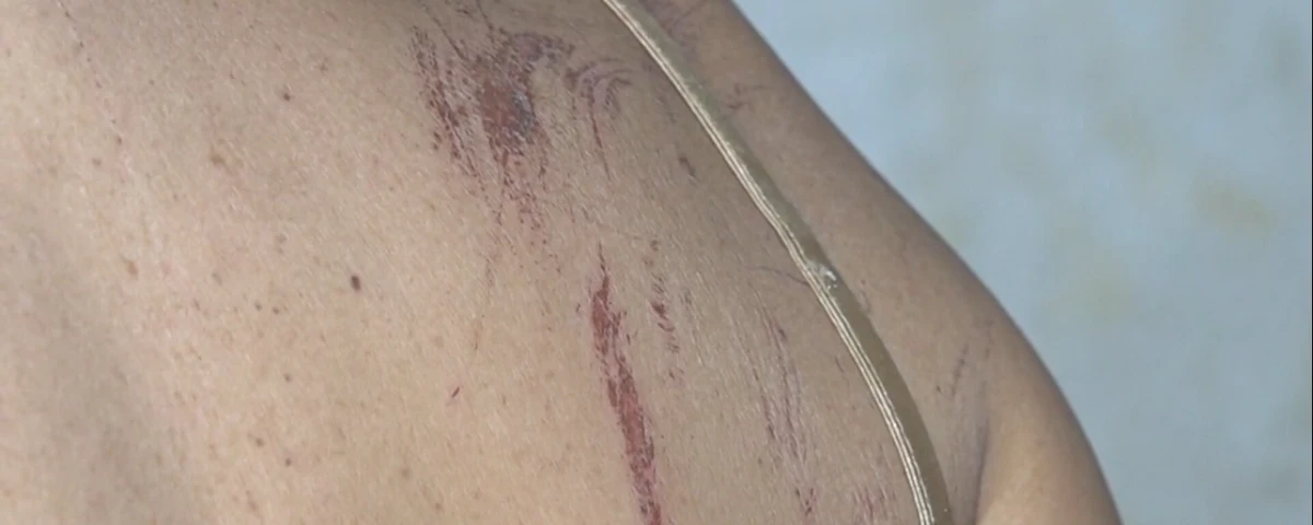 Mulher sobreviveu após ser enterrada viva por Reprodução/TV Bahia