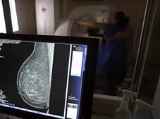 Imagem - Diagnóstico precoce do câncer de mama avança com IA, mas rastreamento segue insuficiente no Brasil