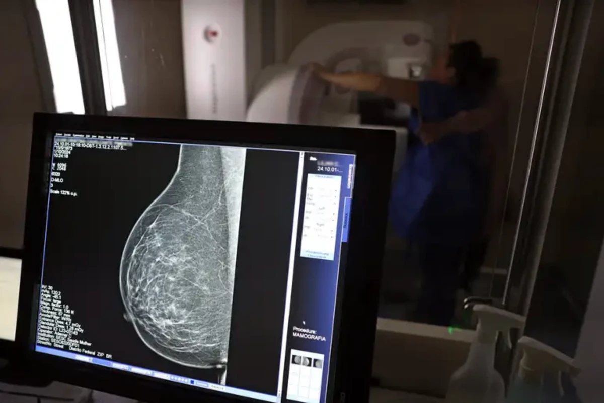 A mamografia foi ampliada no SUS em setembro por José Cruz/Agência Brasil