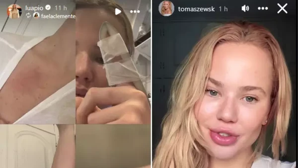 Luana Piovani compartilhou fotos dos ferimentos de Marcela por Reprodução/Instagram
