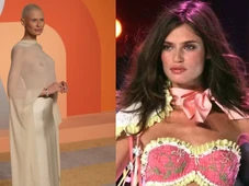 Imagem - Modelo com câncer foi recusada no desfile da Victoria’s Secrets: ‘A vida é curta demais para não tentar’