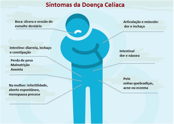 Clínica de Salvador recruta voluntários com doença celíaca para estudo experimental gratuito por Divulgação