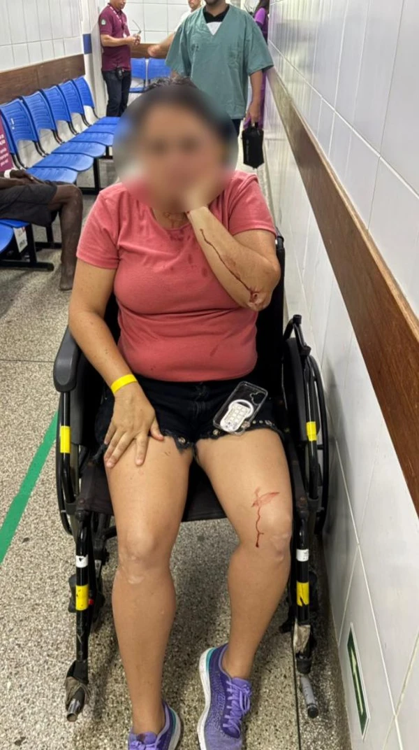 Mulher ataca moradora da Graça com garrafa de vidro por Reprodução