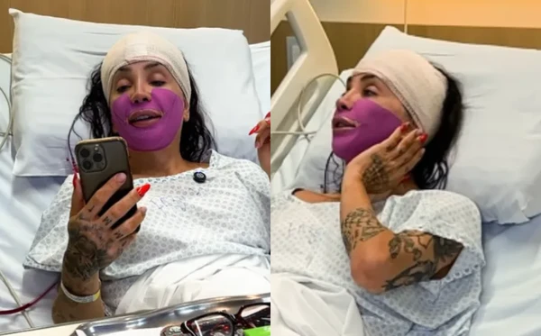 Maya Massafera fez cirurgia para deixar rosto mais delicado