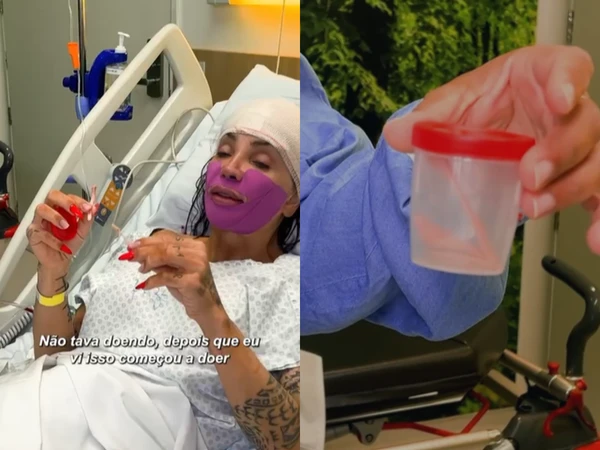 Maya Massafera fez cirurgia para deixar rosto mais delicado por Reprodução