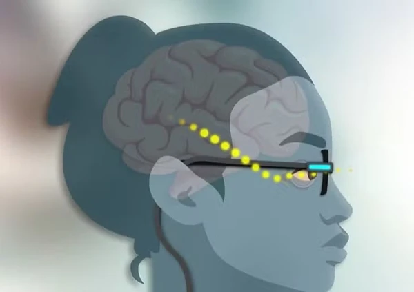 Pacientes usam óculos após inserção do microchip por Reprodução