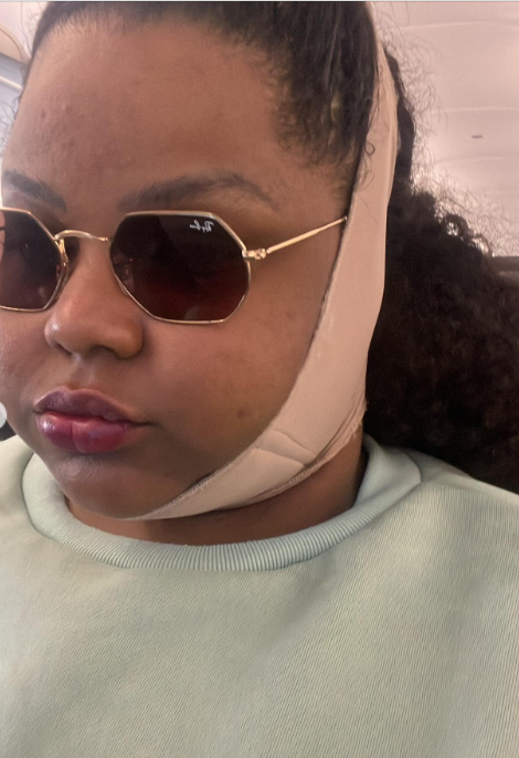 MC Carol: processo de recuperação da 'lipo de papada' por Reprodução / Redes Sociais