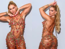 Imagem - Virginia Fonseca faz procedimento estético no bumbum: ‘Vai ser o mais bonito da Sapucaí’