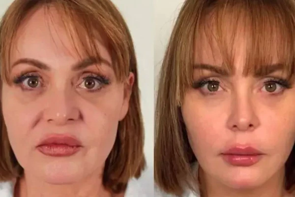 Tranformação da atriz surpreendeu fãs