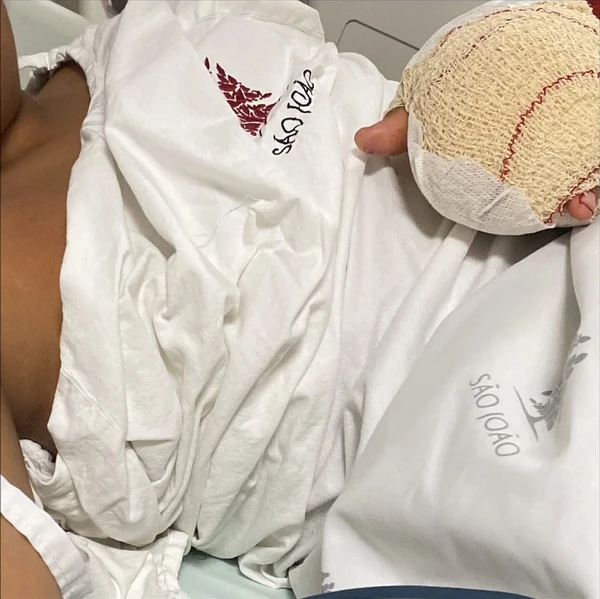 Criança brasileira tem dois dedos amputados por colegas de escola em Portugal: 'eu achava que ia morrer' por Reprodução