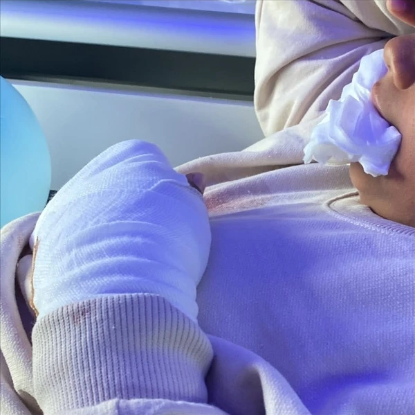 Criança brasileira tem dois dedos amputados por colegas de escola em Portugal: 'eu achava que ia morrer' por Reprodução