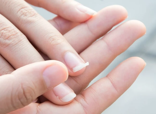 Popularizou na internet um truque inusitado para fortalecer as unhas por Reprodução