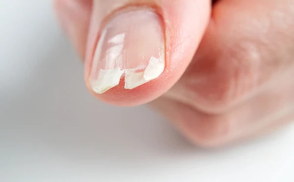 Popularizou na internet um truque inusitado para fortalecer as unhas por Reprodução