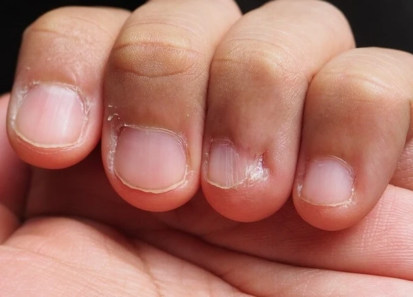 Popularizou na internet um truque inusitado para fortalecer as unhas por Reprodução