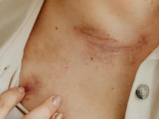 Imagem - Não coma, é inflamatório: os alimentos que ajudam e que atrapalham a cicatrização da pele