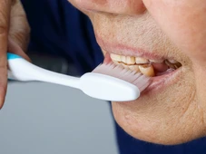 Imagem - Dentes mais sensíveis? Veja o que pode estar causando e como evitar o desgaste