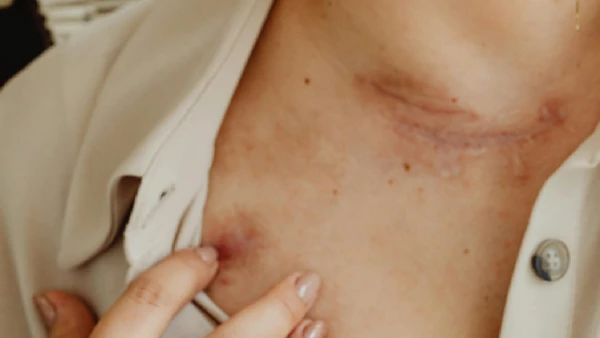 comer bem é fundamental para ter uma pele bonita