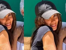 Imagem - Anitta é clicada com curativo e revela remoção de tatuagem mais antiga; confira