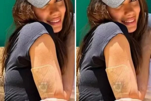 Anitta é clicada com curativo e revela remoção de tatuagem mais antiga por Reprodução/Redes Sociais