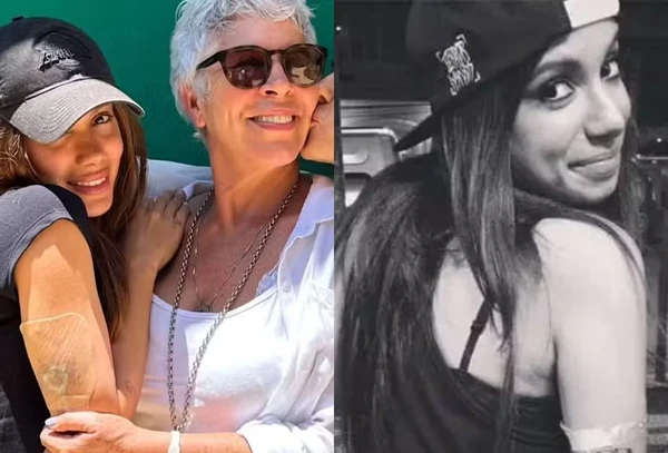 Anitta é clicada com curativo e revela remoção de tatuagem mais antiga por Reprodução/Redes Sociais