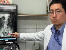 Imagem - Homem vai a hospital com fortes dores abdominais e raio-X revela xícara no ânus