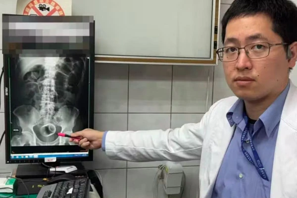 Caso chamou atenção até mesmo de médico