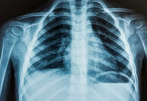 Raio-X identificou objeto estranho em corpo de homem por Reprodução