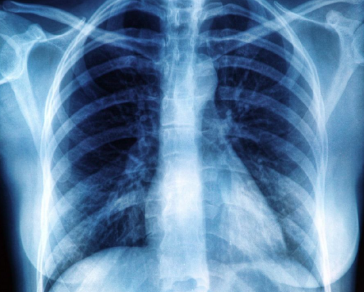 Raio-X identificou objeto estranho em corpo de homem por Reprodução