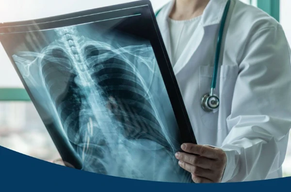 Raio-X identificou objeto estranho em corpo de homem por Reprodução