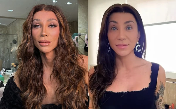 Antes e depois da cirurgia no rosto de Maya Massafera por Reprodução