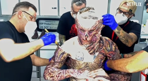 O processo de retirada das próteses durava cerca de quatro horas por Netflix/Reprodução