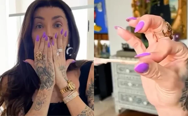 Maya Massafera mostrou resultado de cirurgia no rosto