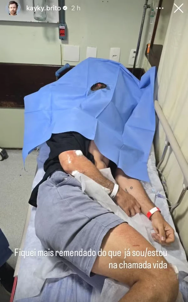  Kayky Brito exibe ferimentos após queda de bicicleta por Reprodução/Instagram