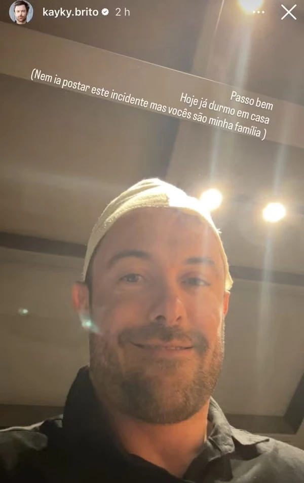  Kayky Brito exibe ferimentos após queda de bicicleta por Reprodução/Instagram