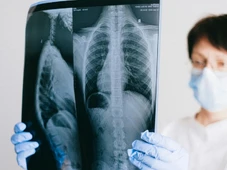 Imagem - Fazer exame de raio-X te deixa com mais risco de ter câncer? Entenda a explicação
