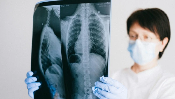 Doutores avaliam com cuidado antes de solicitar uma radiografia