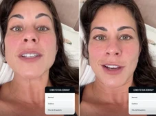 Imagem - Jéssica Senra vai parar na emergência após ataque de gatos